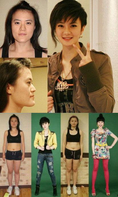 整容非明星,揭秘非明星群体整容背后的故事与心声