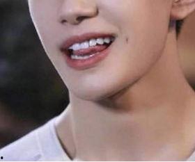 雷公嘴的明星,揭秘明星背后的故事与魅力